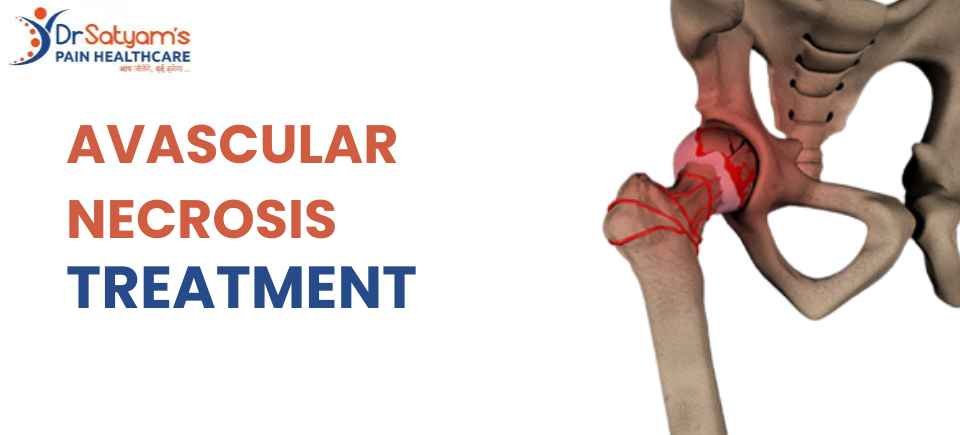 Avascular Necrosis Treatment Varanasi