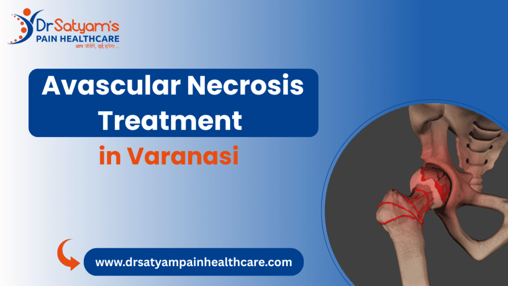 Avascular Necrosis Treatment in Varanasi