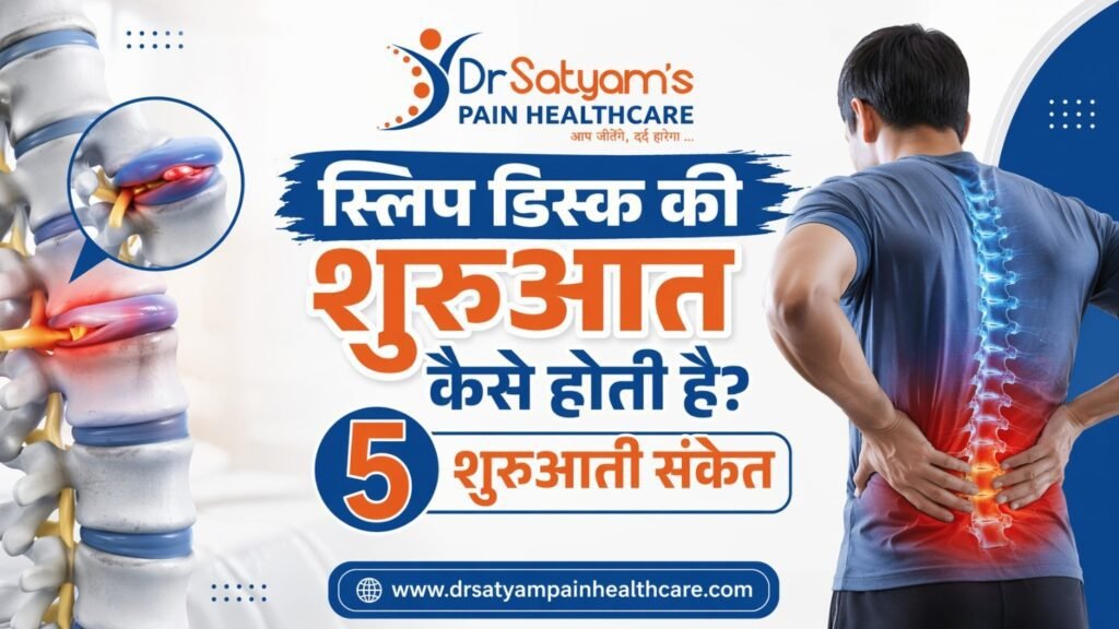 स्लिप डिस्क की शुरुआत कैसे होती है